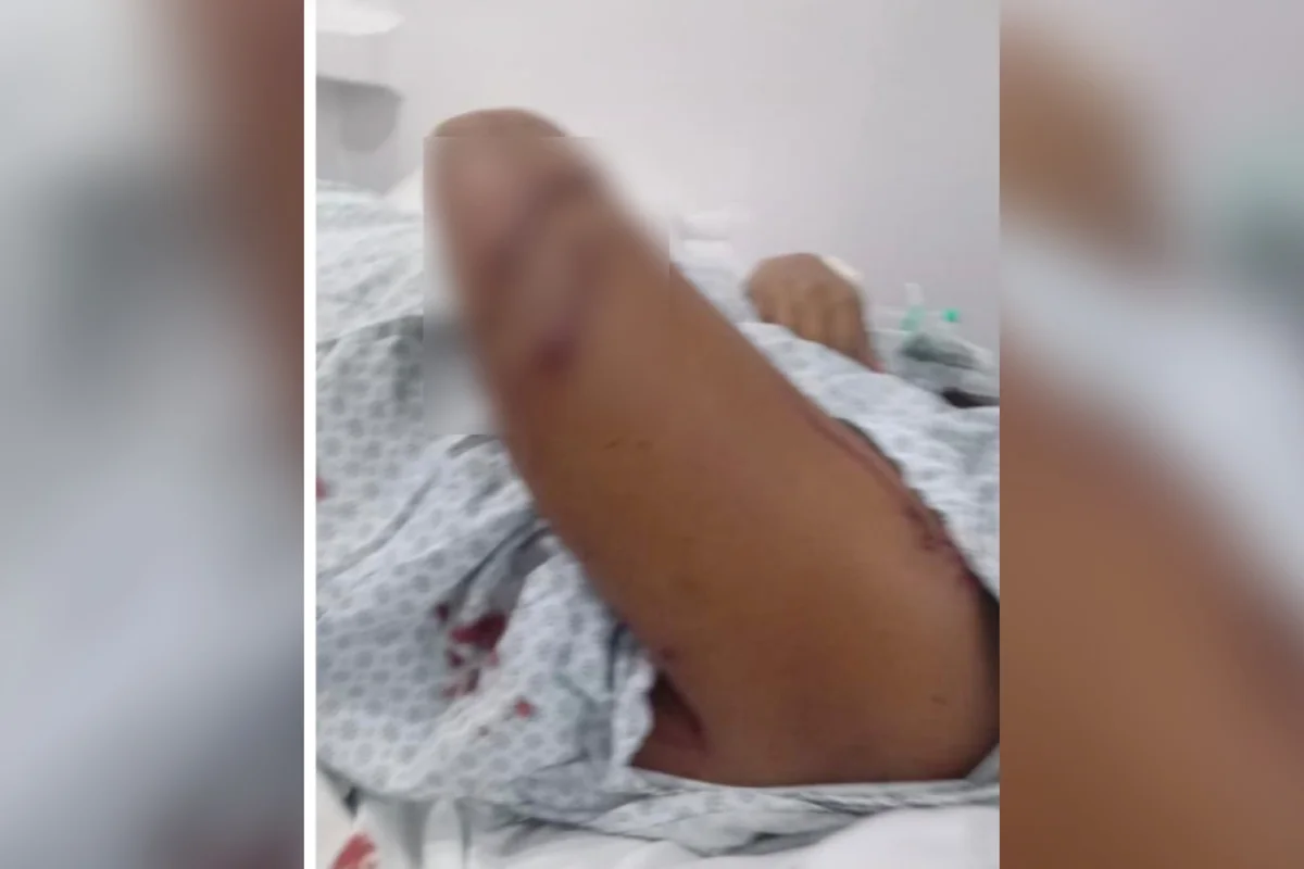 Grávida é atacada com cacos de vidro por namorada do ex-companheiro em GO